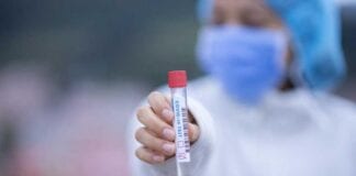 Keep to the guidelines after receiving the COVID-19 vaccine