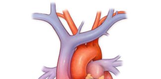 Environmental specialist weighs in on why traditional heart disease factors might actually cost you your life