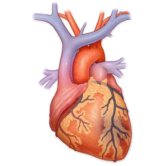 Myocardial-Infarction-An-Unavoidable-Risk-1