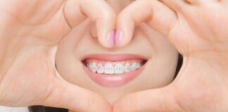 Straightening Smiles in Hereford: Your Guide to Orthodontic Care