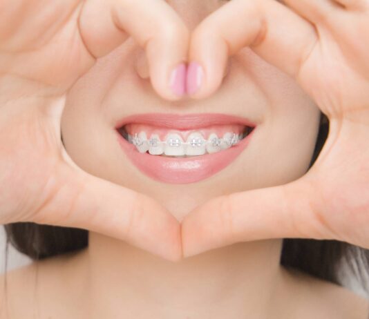 Straightening Smiles in Hereford: Your Guide to Orthodontic Care