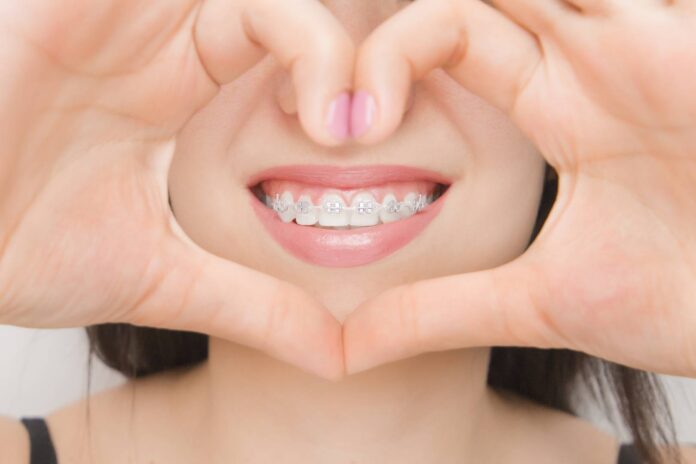 dental-braces-in-happy-womans-mouths-through-the-h-2025-03-05-16-48-34-utc_wp